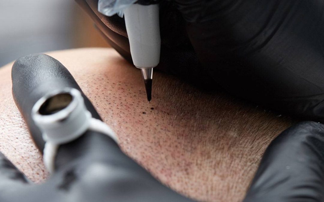 Scalp Micropigmentation (SMP)