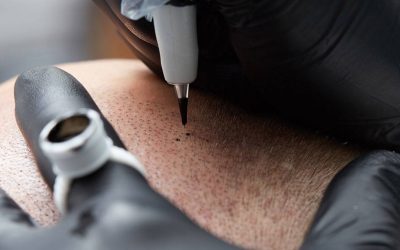 Tekniken bakom mikropigmentering av hårbotten