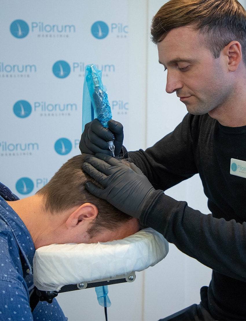 smp-behandling850x1110 Scalp Micropigmentation (SMP) er en behandling der efterligner udseendet af naturlige hårsække.