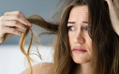 Telogen Effluvium (Hårtab ved stress eller trauma)
