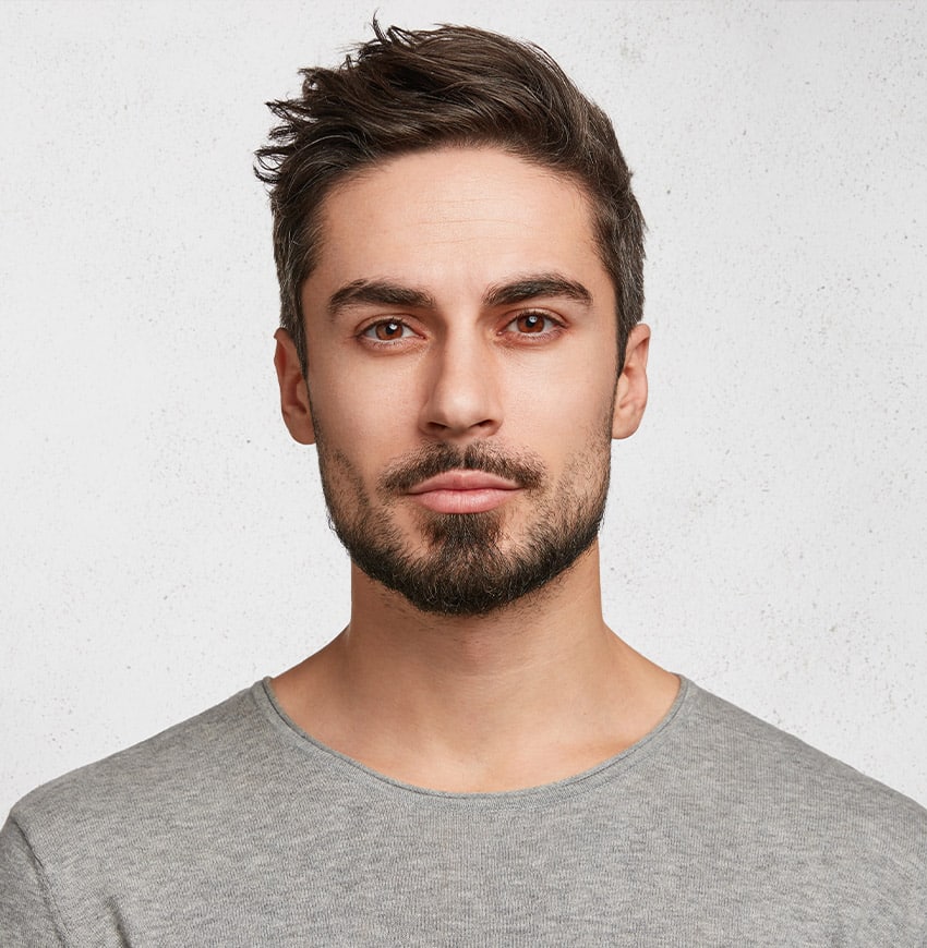 Scalp Micropigmentation (SMP) är en behandling som efterliknar utseendet på naturliga hårsäckar.