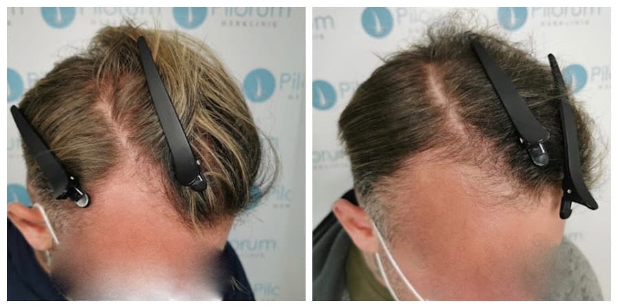 V2X-behandling + extrakt