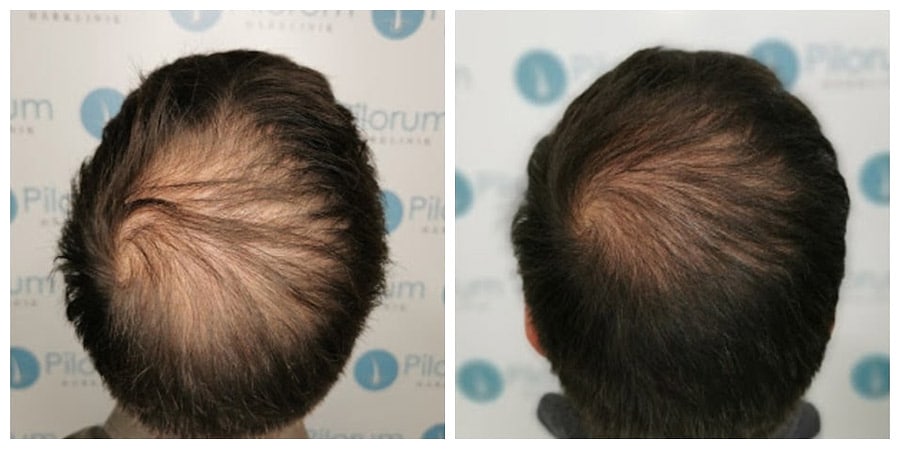 V2X-behandling + extrakt