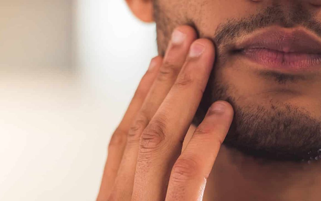 Skægtransplantation