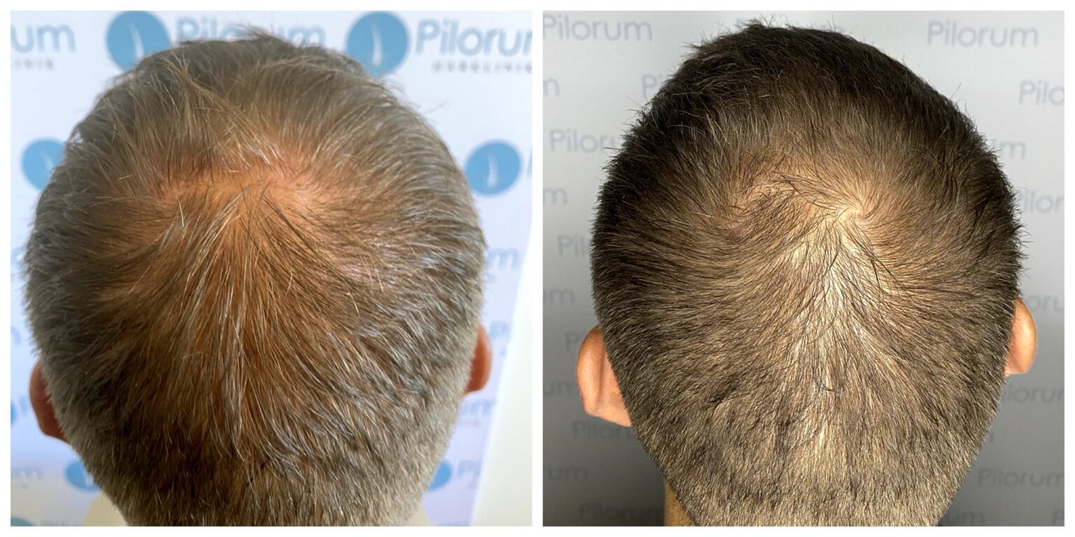 V2X-behandling + Ekstrakt